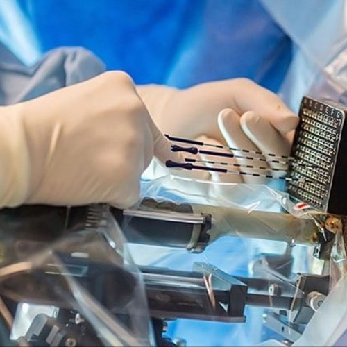 Specialists of Obninsk Research and Production Enterprise “Technologiya” developed a new device for the treatment and diagnosis of malignant tumors by radiation therapy